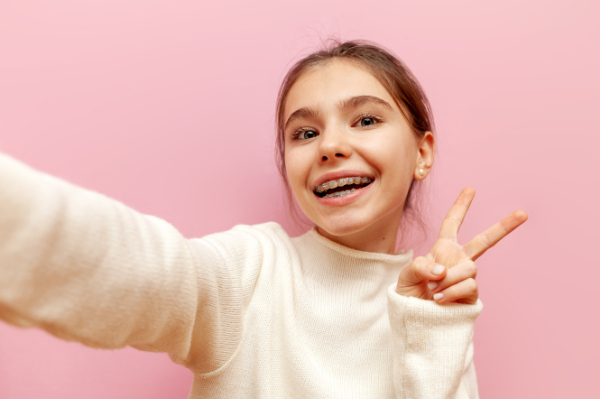 ピースで笑顔を見せるワイヤー矯正をする女の子