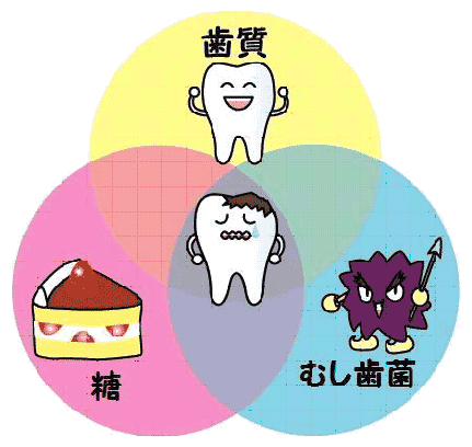 虫歯をできなくする方法