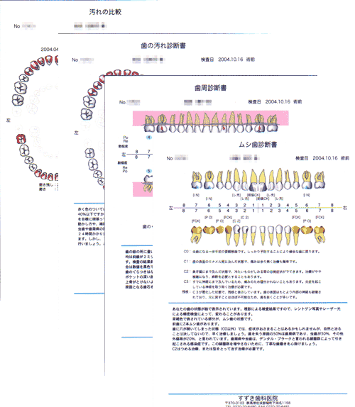 リスク検査